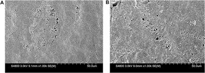 Effect and degradation pathway of sulfamethoxazole removal in MBR by PVDF/DA modified membrane